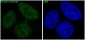 Anti-ER alpha ESR1 Rabbit Monoclonal Antibody